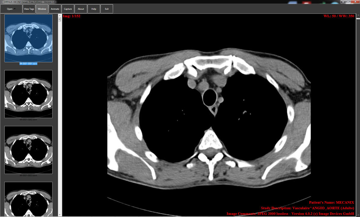 OrpalisDicomViewer - Created by PostDICOM